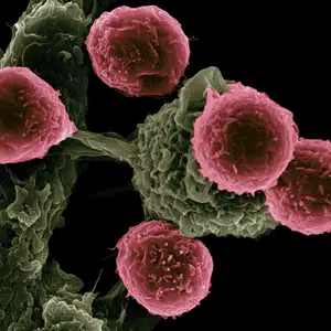 Early HIV Symptoms in Women: Risk Factors and When Evaluation Matters